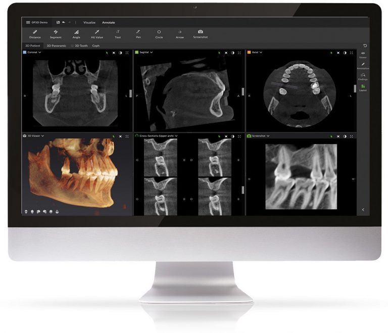Cone Beam Computed Tomography (CBCT) Clifton Park Periodontics